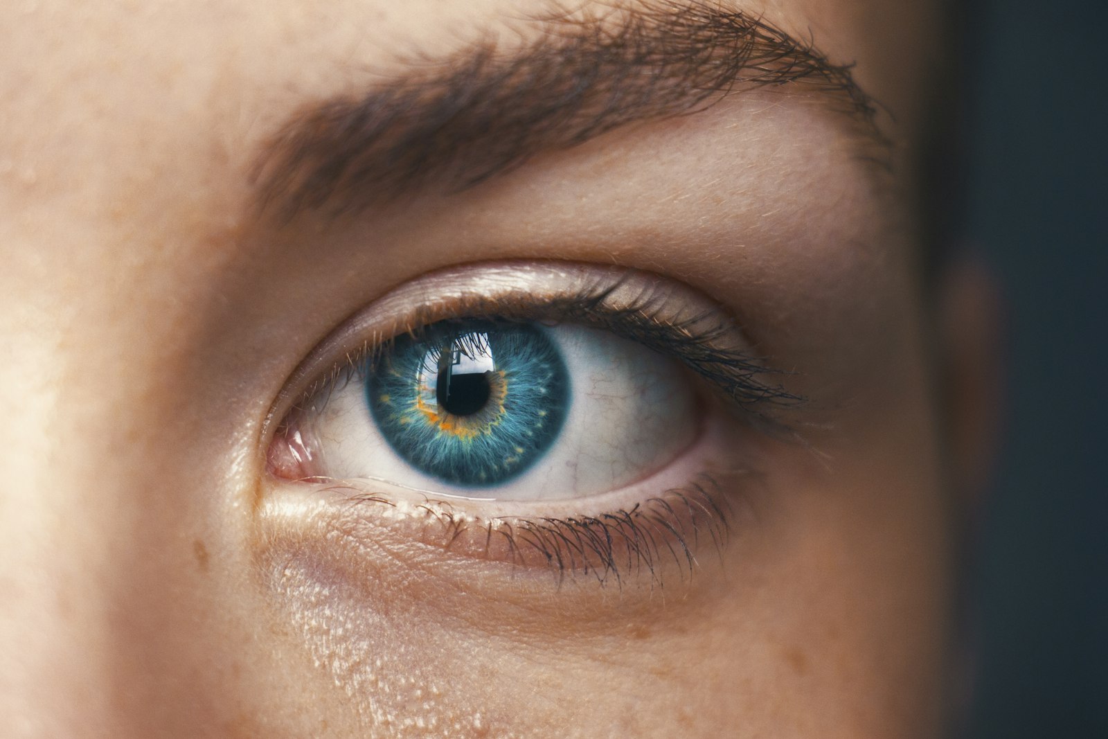 Direct Brow Lift: Recovery, Scars and What to Expect - Dr Filis Ayan London Direct brow lift recovery: close-up of a woman's eyes and brow area